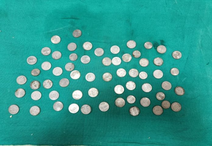 In Jodhpur, 63 coins came out of the stomach of the youth, the team of doctors was also surprised