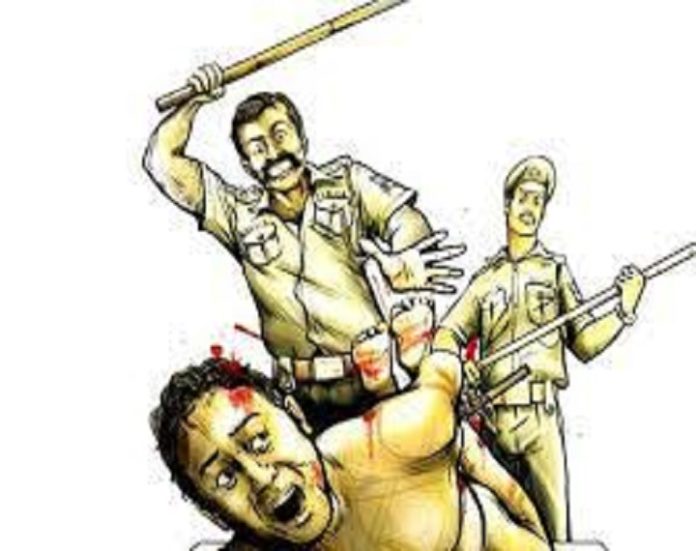 Khaki again put you to shame: In Bareilly, police beat a villager thinking he was a gambler, he died during treatment.